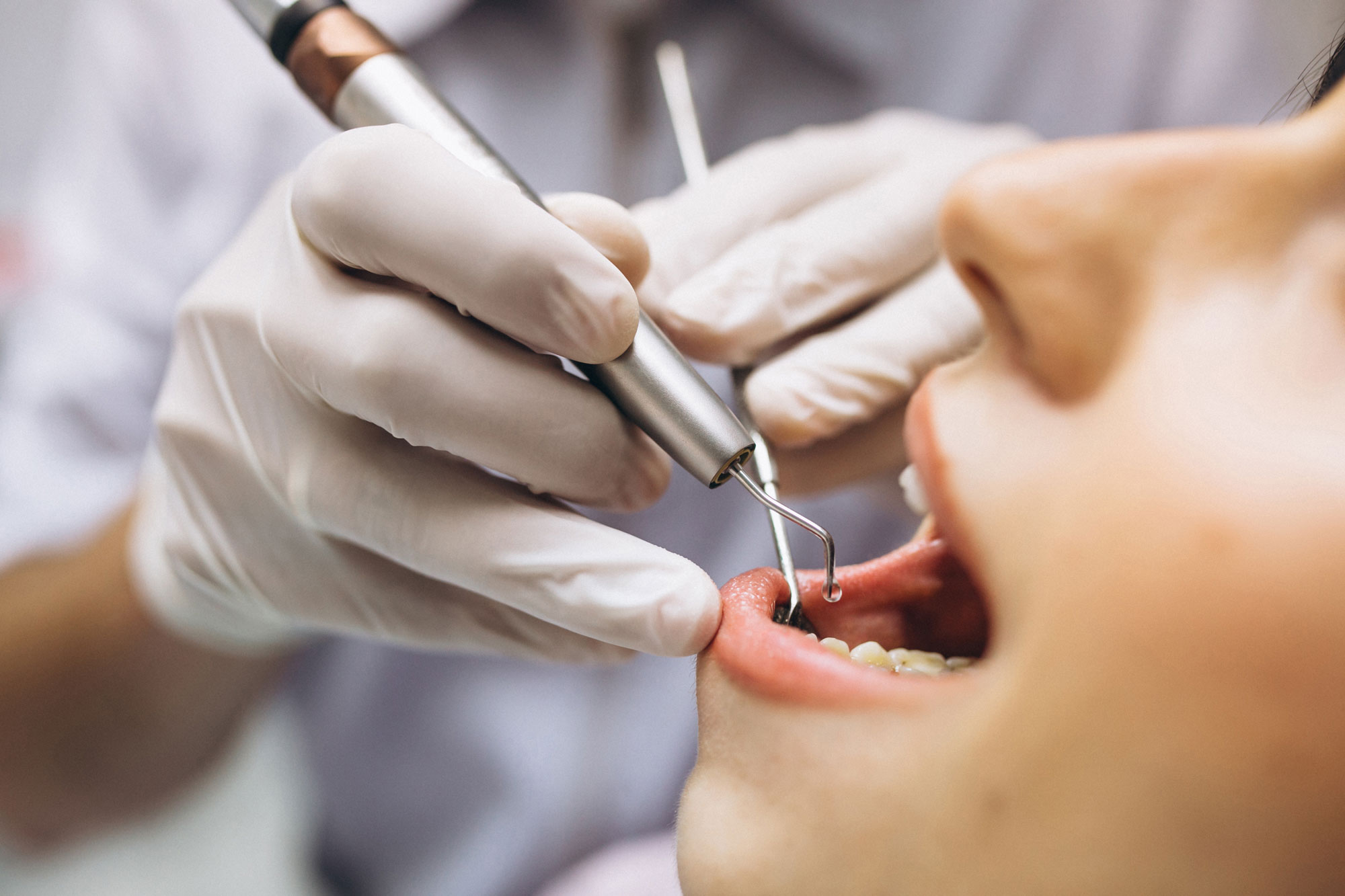 endodoncia-en-leon